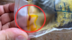 恐怖！广西男子吃鱼生30年 身上插导管亲眼看见虫子爬出体内