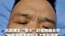 抗癌博主“李大”肝癌晚期去世“肿瘤消除速度赶不上生长速度”最后的视频中吃着冰棍挥手告别：再见了，再见了…