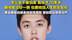 官宣回归仅3个月，27岁歌手郭聪明接受手术，事业巅峰时自曝患特发性震颤