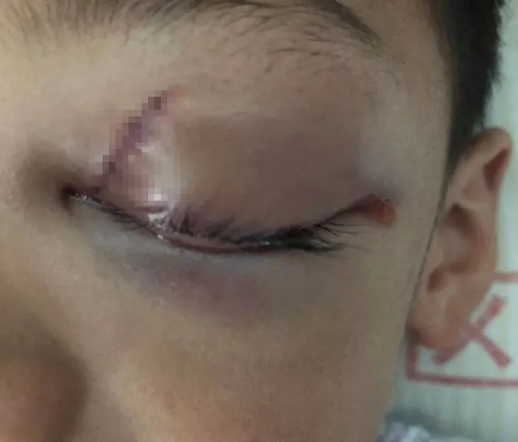 妈妈刚低头吃饭，撕心裂肺的哭声传来！3岁娃竟被挂在门上…十大夺命家具必须了解（吃饭的时候妈妈让我必须把碗里的蔬菜吃光修改病句）