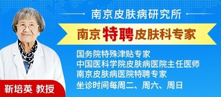 南京有名的皮肤科医院是哪个