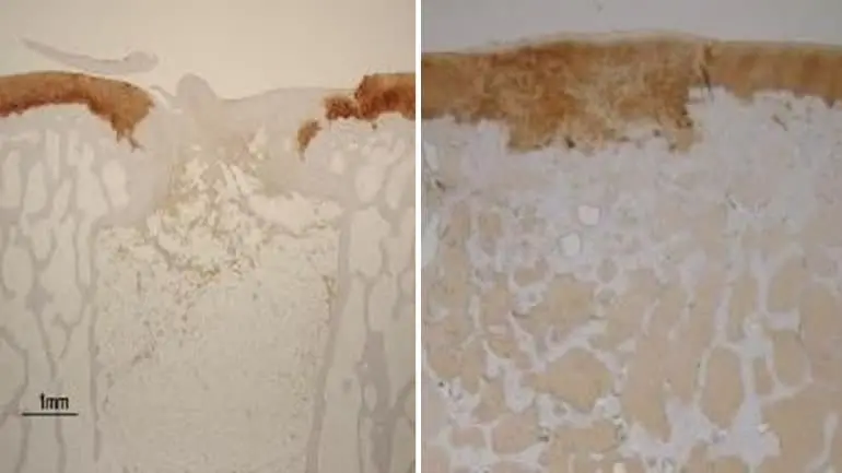 再生前后的膝关节软骨与骨骼