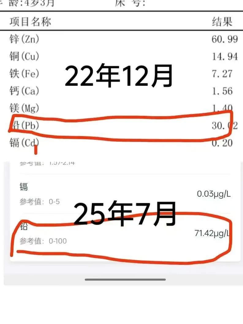 一位从涉事幼儿园毕业孩子时隔两年半的血铅检测结果。 受访者供图