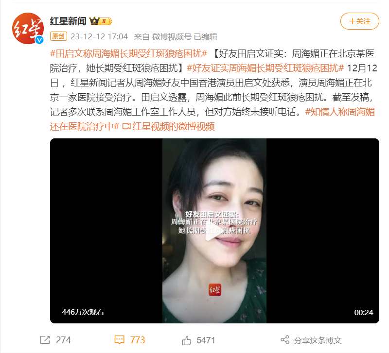 演员周海媚长期受红斑狼疮困扰，这种“不死的癌症”尤其偏爱女性