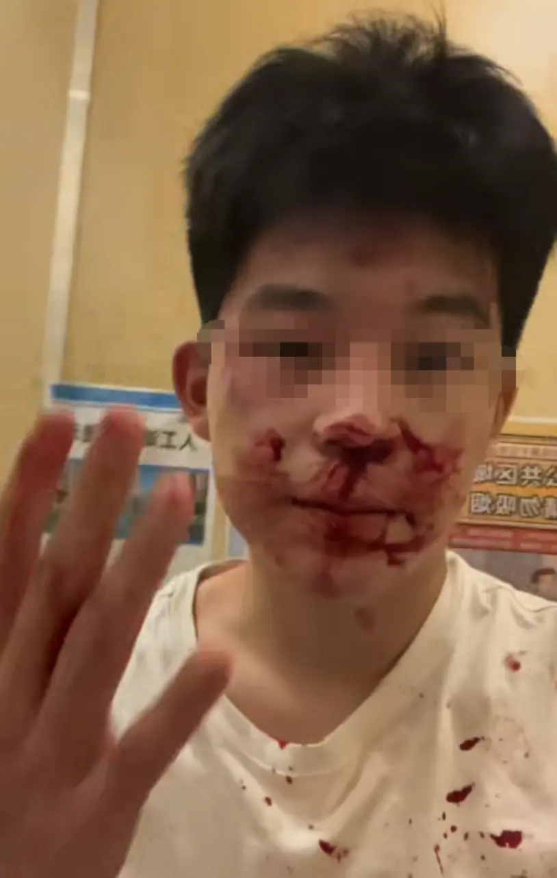 17岁男生遭假警察骗出门殴打,被诊断抑郁_快讯_第2张_纵横网 17岁男生遭假警察骗出门殴打,被诊断抑郁_https://www.izongheng.net_快讯_第2张