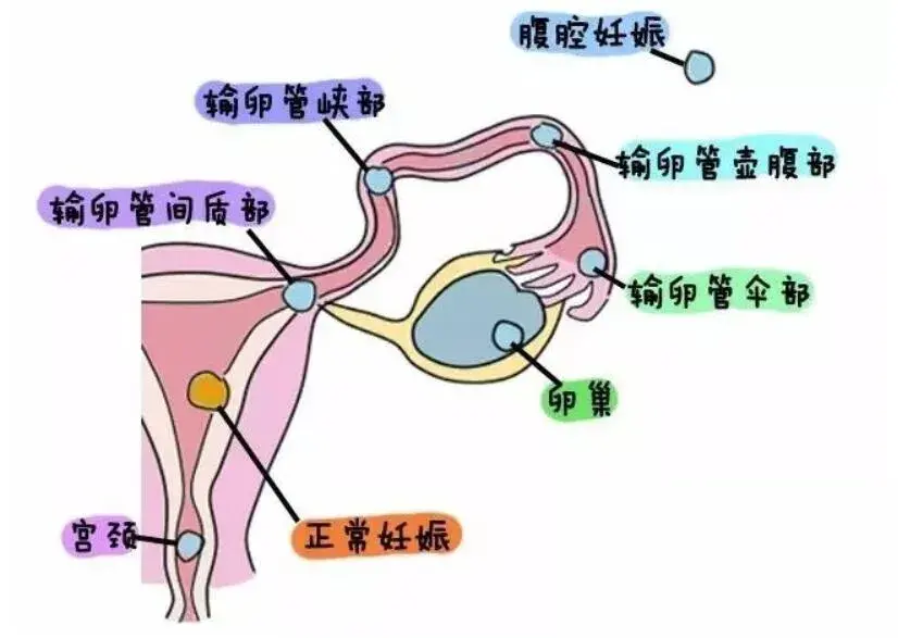 这都可以？（怀孕两条杠整蛊）怀孕两条杠还是一条杠 第5张