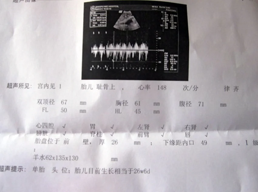 干货分享（愚人节整蛊怀孕b超单）愚人节整蛊神器怀孕报告单 第4张