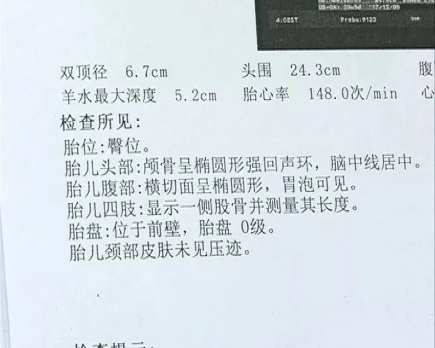 干货分享（愚人节整蛊怀孕b超单）愚人节整蛊神器怀孕报告单 第3张