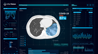 智能医生的缔造者 新冠肺炎AI影像辅助诊断系统